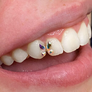 Tooth Gems