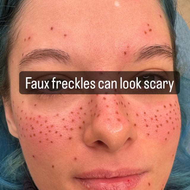 Swipe to see progress 
Faux freckles
This is a buildable service and is best when done in two or more sessions. 
I use unmodified mineral pigments so these faux freckles will last up to a year. 
They look intense when right off the needle but these pigments fade 50% in the healing process. In the second session I created bigger freckles to mix in and laid the pigment down a bit more saturated now that I understand her skin and how it heals. In about 4 weeks when they are fully healed again they will be super cute and make her makeup routine will be so simple. 
**text boxes to protect my my clients identity. 
**yes faux freckles are a thing- it's a vibe for many but perhaps not yours. But I have always been busy with my freckle clients and they return year after year. 🥰
WANT MORE INFO??
call/text 07932751046 christina@glasgowbrows.com @christina_james_ink glasgowbrows.com 
xoxo 
Christina 

Microblading 🤍 Eyeliner Tattoo🤍 Lip Blush🤍permanent makeup🤍milngavie🤍eyebrows  #eyebrowsglasgow #milngavie #permanentmakeup #microbladingglasgow